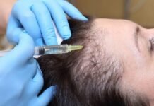Things You Need to Know About Hair Loss Treatment