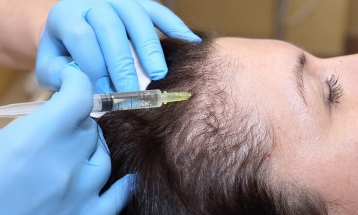 Things You Need to Know About Hair Loss Treatment