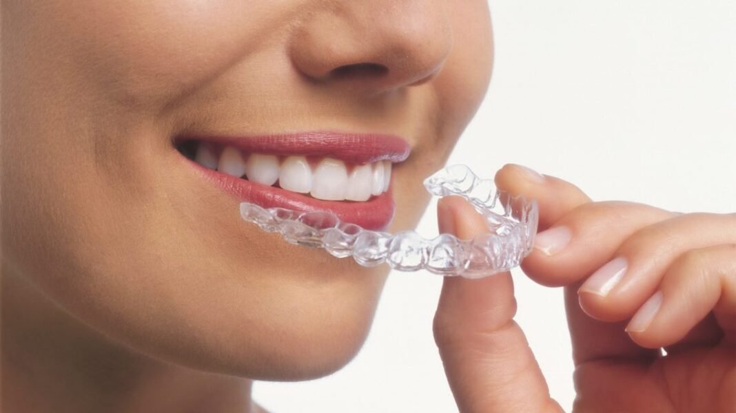 Factors to Consider Before Getting Clear Aligners