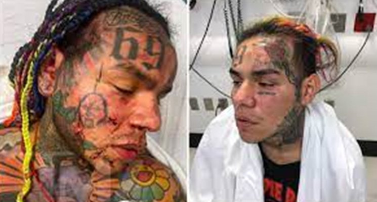 6ix9ine beaten and 6ix9ine Jumped 